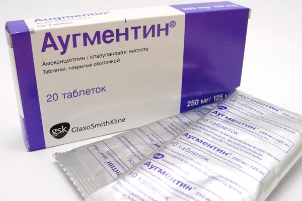 antibiotici za bolovima zglobova)