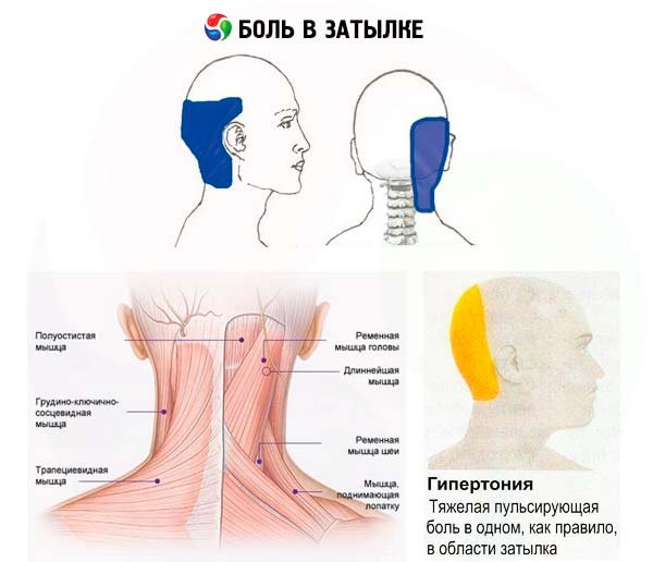 bol u stražnjem dijelu glave i zglobovima)
