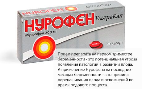 Nurofen tijekom trudnoće