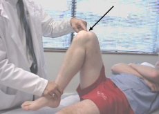 prigovaralo bol u zglobu koljena artroza početnog stadija liječenja zgloba koljena