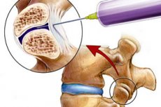 bol u zglobu koljena ligamenata liječenje artroze koljena burdokom