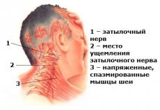 bolovi u zglobovima u stražnjem dijelu glave i vratu gimnastika za bolove u ramenskim zglobovima