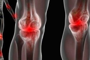 metatarzofalangalnih bol u zglobovima artroza liječenja koljena u gležnju