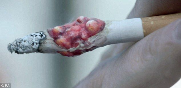 U Velikoj Britaniji je pokrenula užasne cigarete protiv reklamiranja