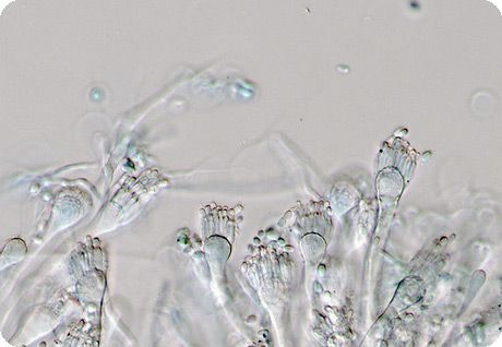 Jedna od gljiva roda Aspergillus 