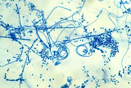 Uzročnik epidermofitoze stopala (Trichophyton interdigitale)